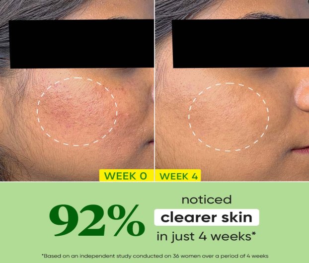 DOT & KEY CICA + NIACINAMIDE OIL - FREE MOISTURIZER 60 ML