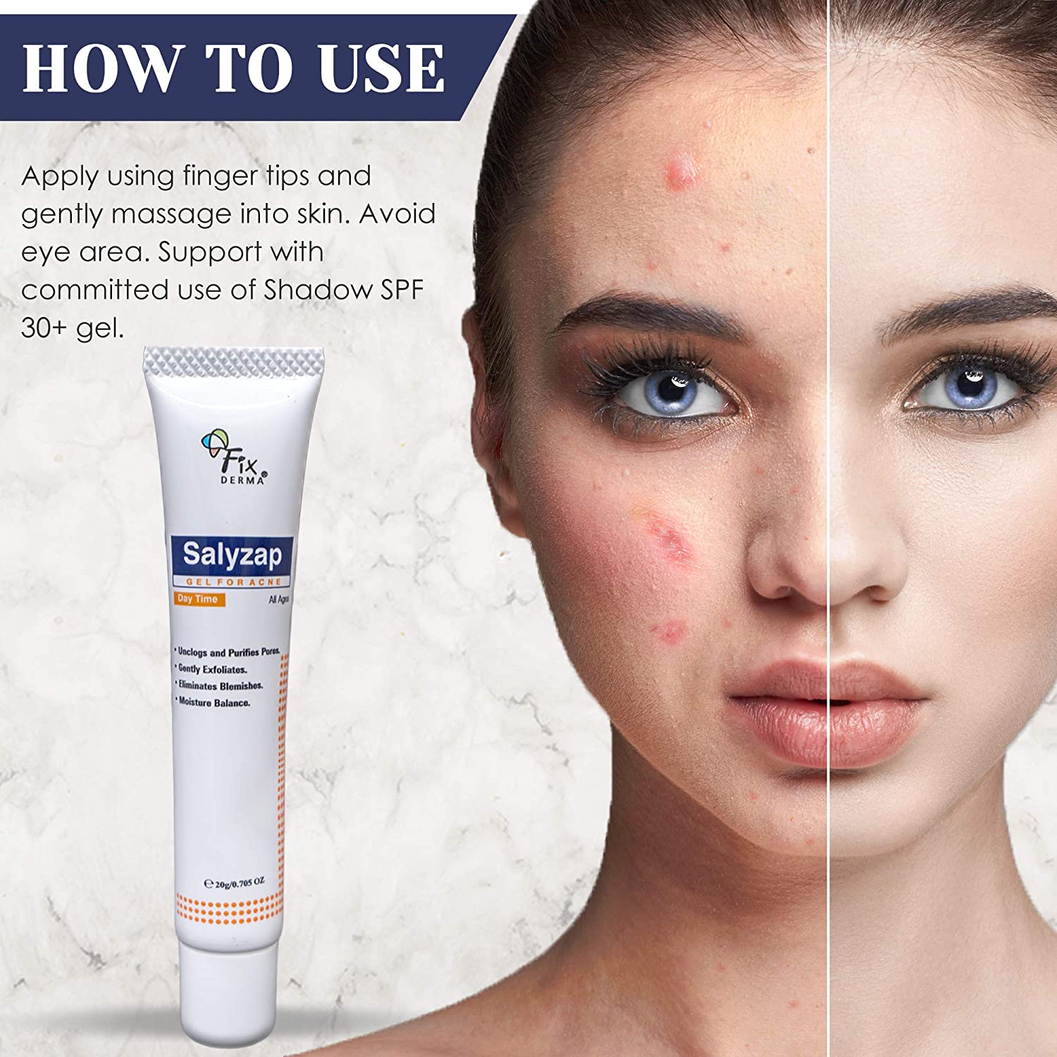 FIXDERMA SALYZAP GEL FOR ACNE DAY TIME 20G